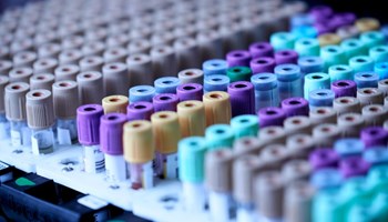 Scientists call for standardisation of allergy tests after laboratory trials showed commercially available tests are not uniformly reliable